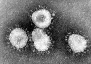 Coronavirus : Des cas confirmés à Saint-Martin et Saint-Barthélémy