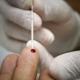 Journée mondiale de lutte contre le Sida : « la pandémie de covid19 aurait eu un impact sur le dépistage du VIH »
